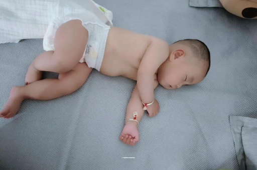 荆州六个月宝宝眼睛散光
